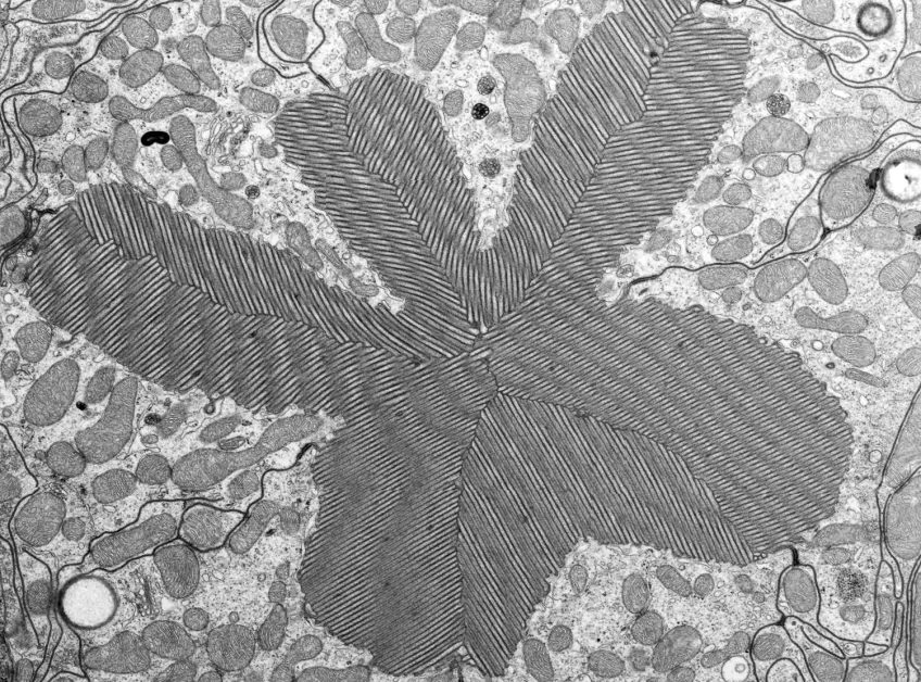 A transmission electron microscope photo of a rhabdomen. 