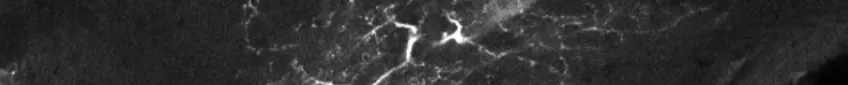 Part of confocal image. Photo.