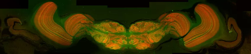 A confocal laser scanning microscope photo.
