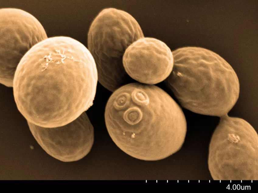 Scanning electron microscope photo of yeast cells.