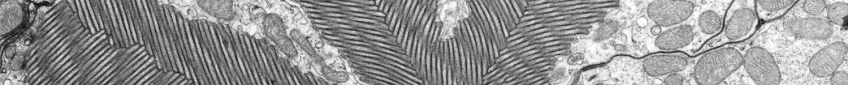 Part of a transmission electron microscope photo.