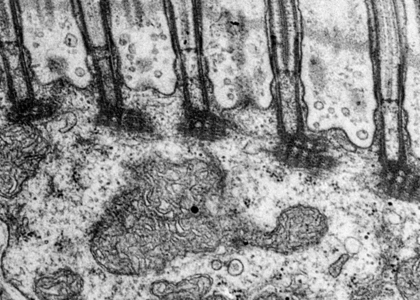 A transmission electron microscope photo.