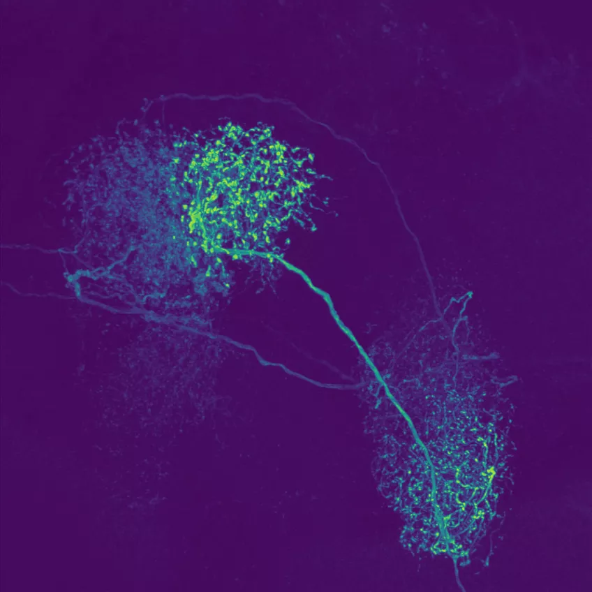 A confocal laser scanning microscope photo.