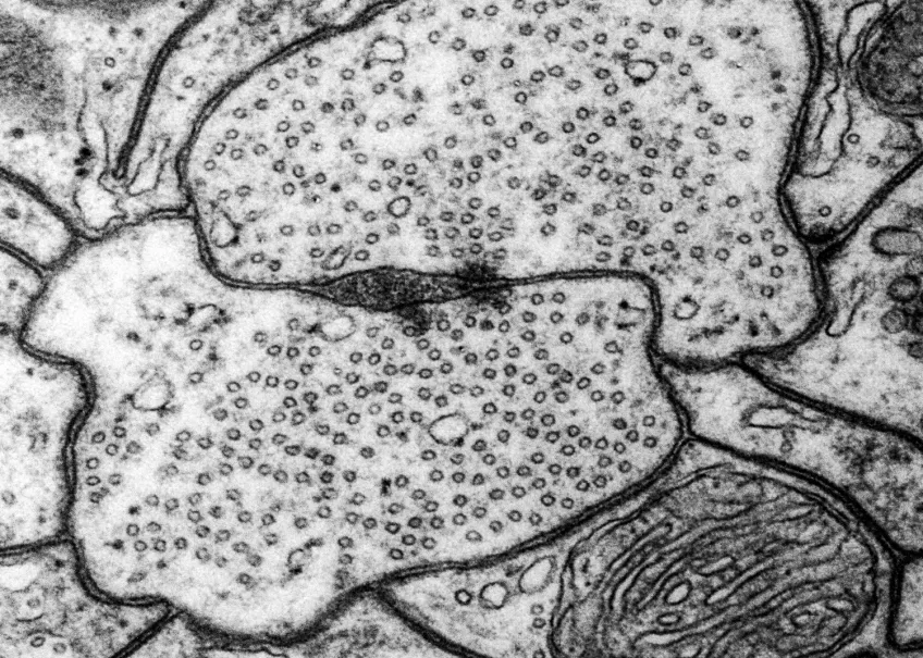 A transmission electron microscopy photo.