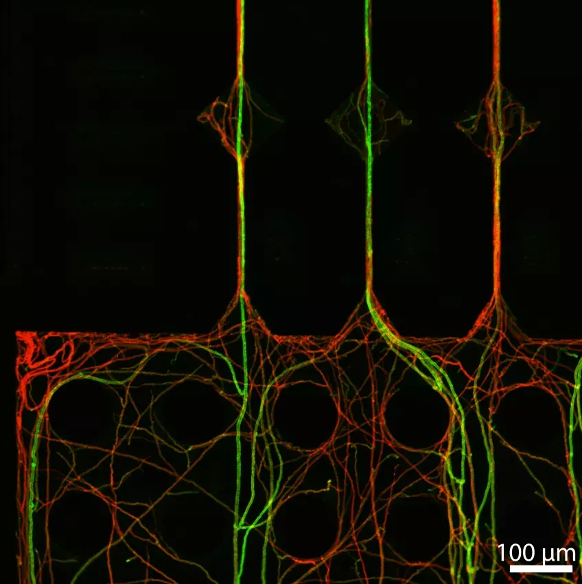 Microscope image of fungi hyphae. Photo.